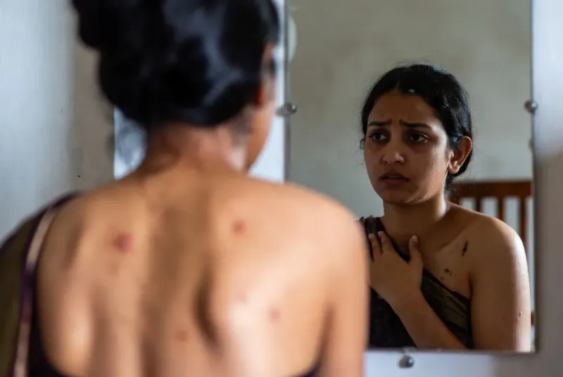 শরীরের ব্রণ বা বডি একনি দূর করার উপায়: কারণ ও ফুল বডি ক্লেনজিং রুটিন