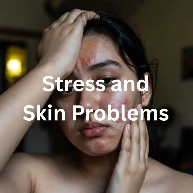 স্ট্রেস ও ত্বকের সমস্যা: কর্টিসল কীভাবে আপনার ত্বকের সর্বনাশ করে?